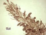 8 – Assi fertili claviformi avvolti da spermatocisti su una ramificazione laterale ad accrescimento determinato